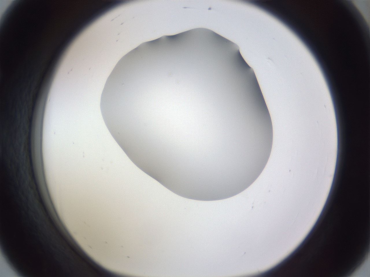 folderID405_plateID2405_batchID11613_wellNum56_profileID1_d1_r178257_ef.jpg