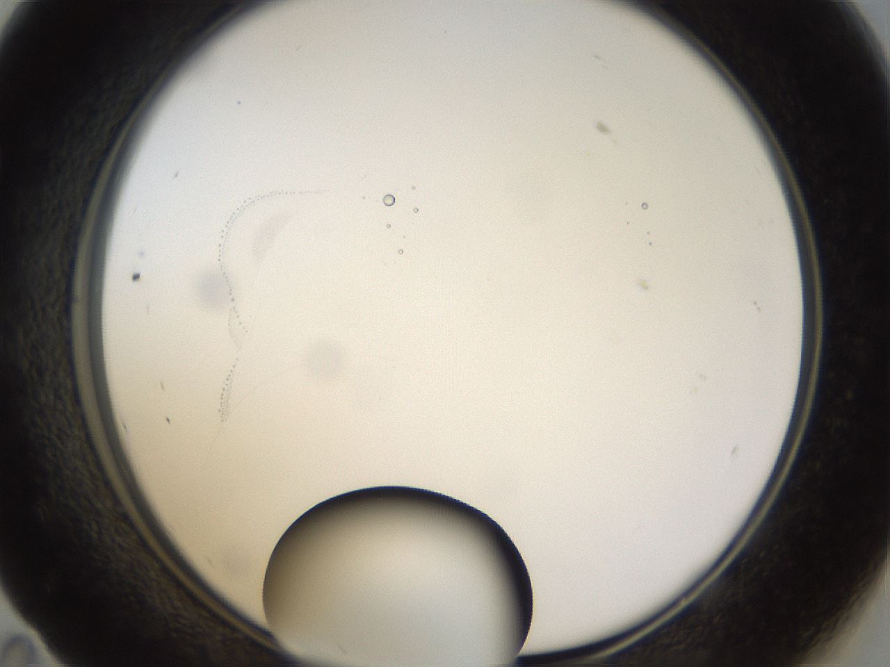 folderID40_plateID1040_batchID2096_wellNum59_profileID1_d1_r45692_ef.jpg