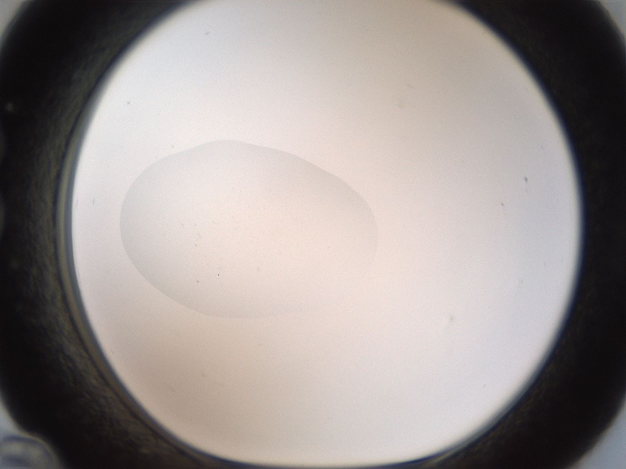 folderID40_plateID2040_batchID8993_wellNum36_profileID1_d1_r137533_ef.jpg
