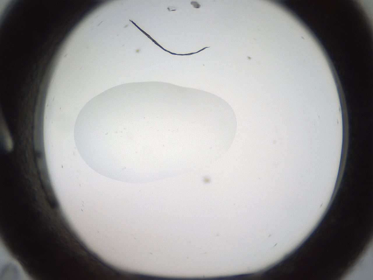 folderID40_plateID2040_batchID9008_wellNum11_profileID1_d1_r137483_ef.jpg
