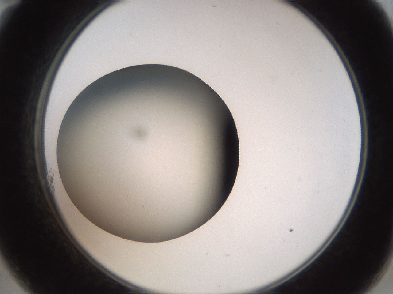 folderID40_plateID2040_batchID9008_wellNum11_profileID1_d2_r137484_ef.jpg