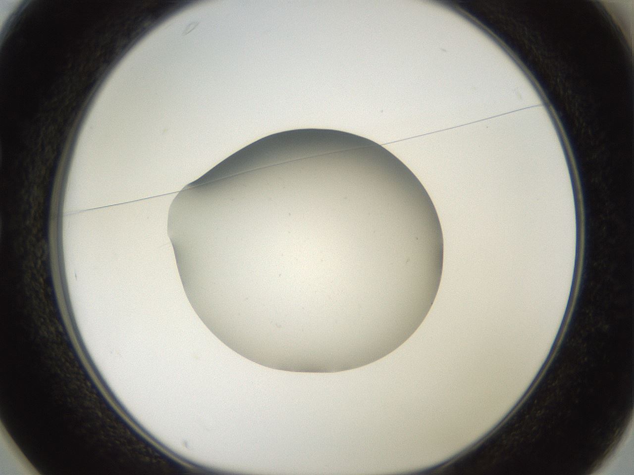folderID40_plateID2040_batchID9008_wellNum25_profileID1_d1_r137511_ef.jpg