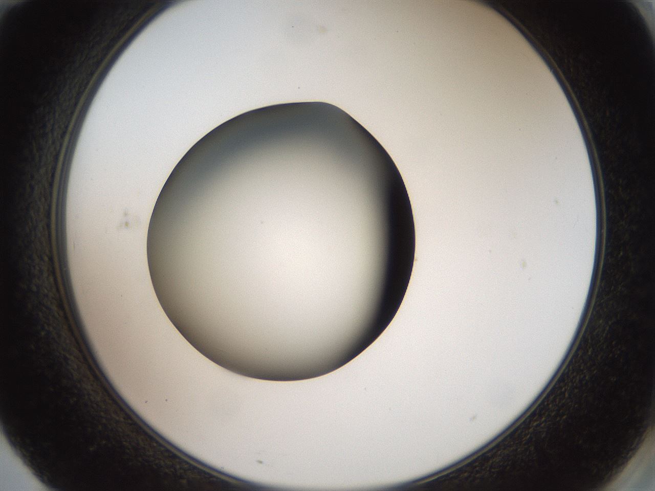 folderID40_plateID2040_batchID9008_wellNum71_profileID1_d2_r137604_ef.jpg