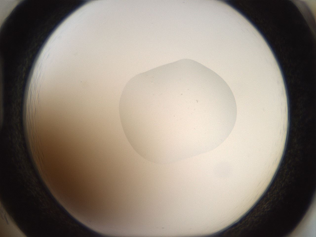 folderID40_plateID2040_batchID9008_wellNum85_profileID1_d1_r137631_ef.jpg