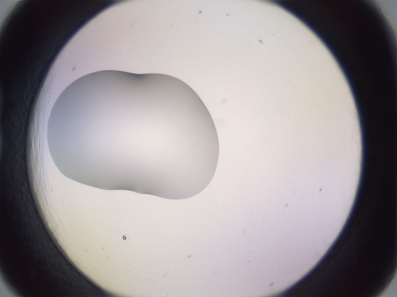 folderID410_plateID1410_batchID5183_wellNum18_profileID1_d1_r86339_ef.jpg