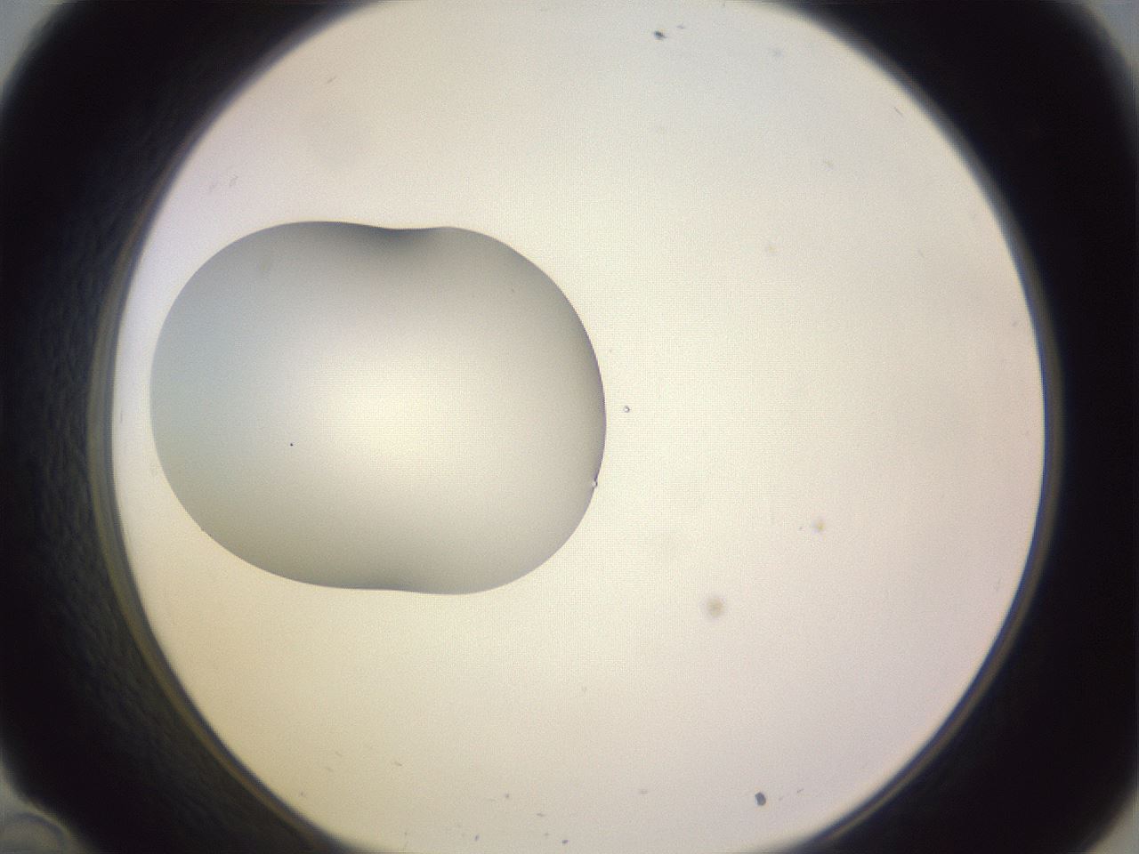 folderID410_plateID1410_batchID5183_wellNum34_profileID1_d1_r86355_ef.jpg