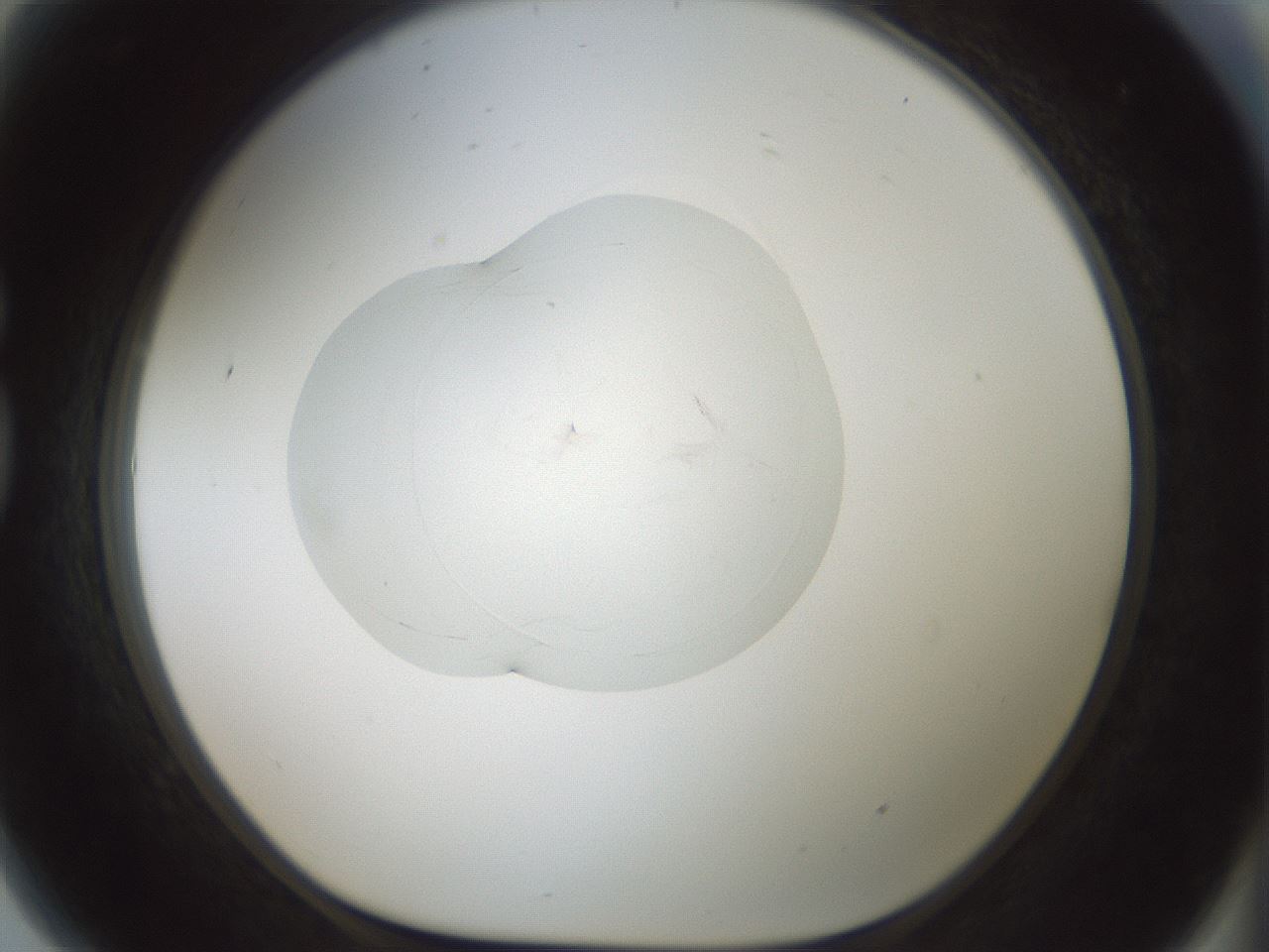 folderID414_plateID1414_batchID5189_wellNum81_profileID1_d1_r86786_ef.jpg