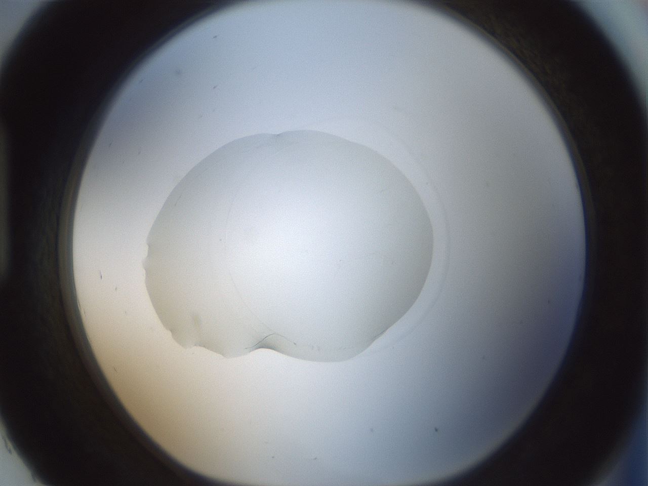 folderID414_plateID1414_batchID5189_wellNum93_profileID1_d1_r86798_ef.jpg