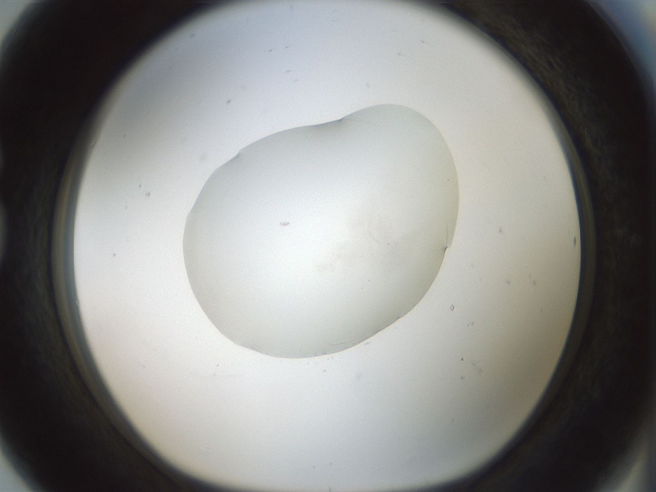 folderID415_plateID1415_batchID5192_wellNum80_profileID1_d1_r86977_ef.jpg