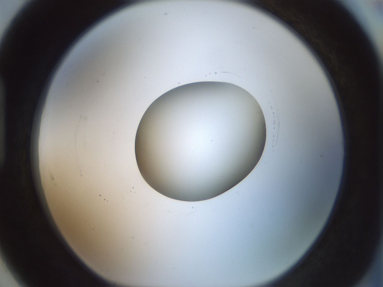 folderID415_plateID1415_batchID5192_wellNum91_profileID1_d1_r86988_ef.jpg